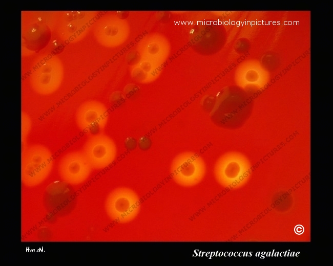 Streptococcus Agalactiae In A Mixed Culture With Nonhemolytic Colonies ...